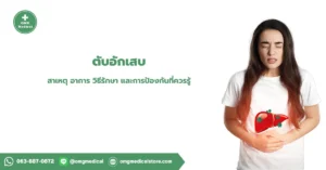 ตับอักเสบ