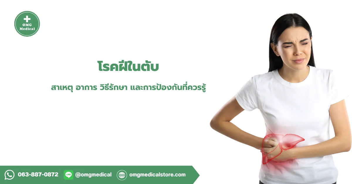 ฝีในตับ