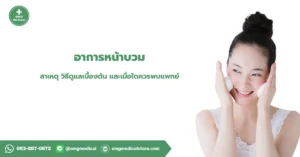 อาการหน้าบวม