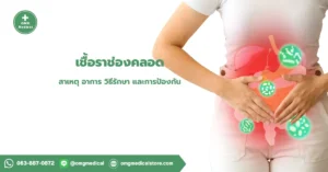 เชื้อราช่องคลอด