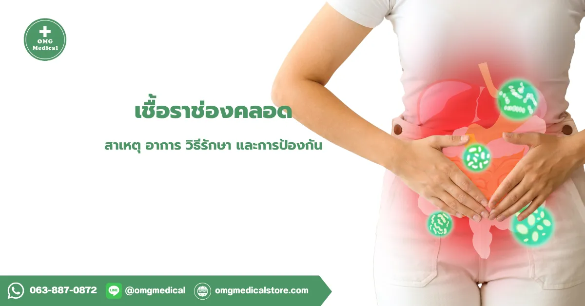 เชื้อราช่องคลอด