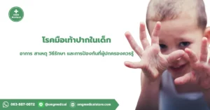 โรคมือเท้าปาก