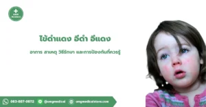 ไข้ดำแดง