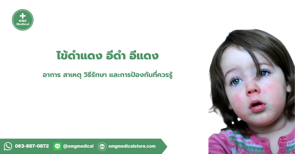 ไข้ดำแดง